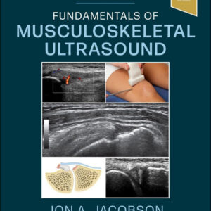 Fundamentals of Musculoskeletal Ultrasound (Fundamentals of Radiology) 4th Edition by Jon A. Jacobson