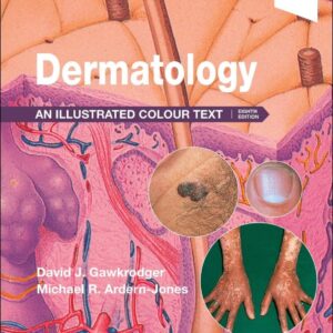 Dermatology An Illustrated Colour Text by David Gawkrodger 2025