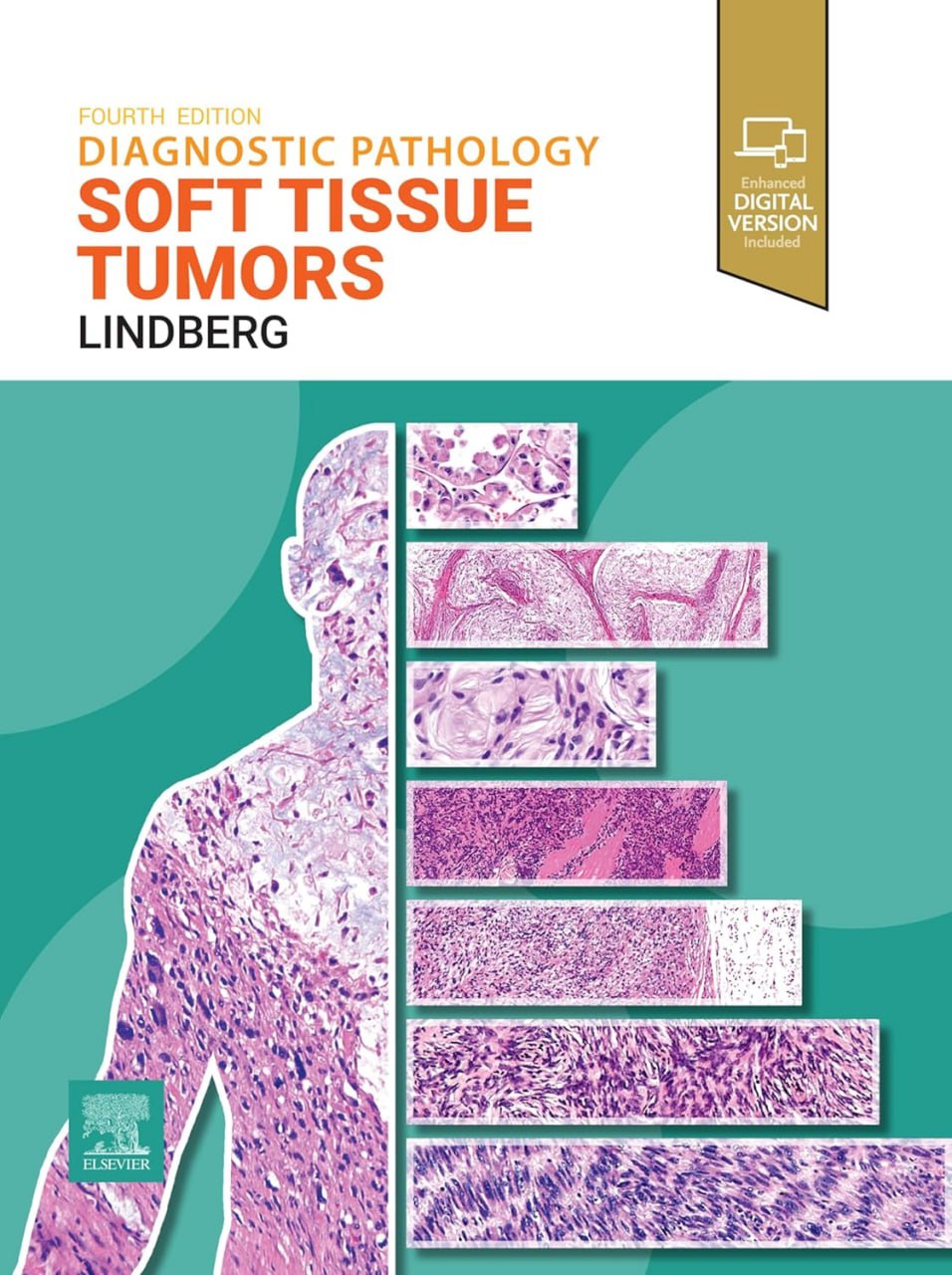 Diagnostic Pathology: Soft Tissue Tumors by Matthew R. Lindberg 2023