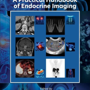 A Practical Handbook of Endocrine Imaging 1st Edition by Joseph M. Pappachan  2025
