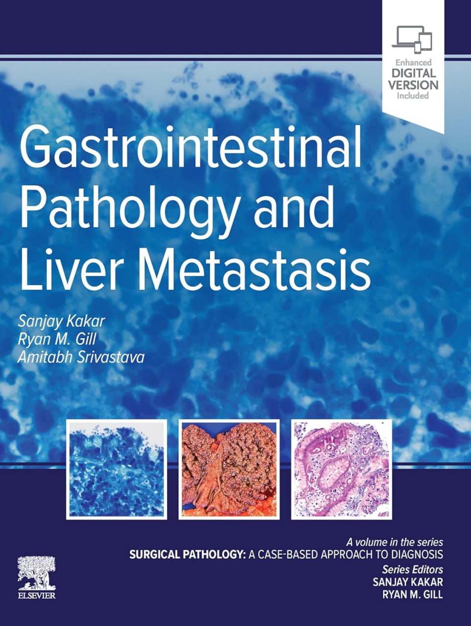 Gastrointestinal Pathology and Liver Metastasis A Case-Based Approach to Diagnosis by Sanjay Kakar 2025